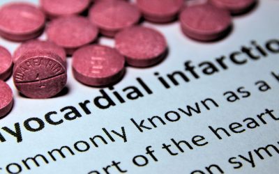 Nurses’ Guide to Myocardial Infarctions